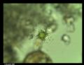 Staurastrum sp.